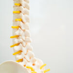 Axiale spondyloartritis