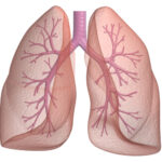 COPD